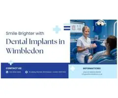 Smile Brighter with Dental Implants in Wimbledon!