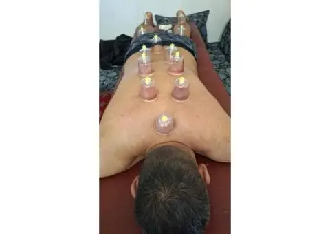 Cupping Therapy for Health Practitioners: The Hijama Approach - 1/3