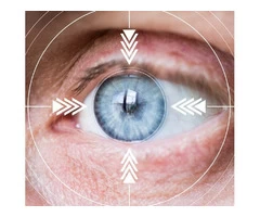 Best Eye Test Catford