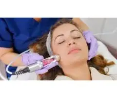 Laser Genisis By Cutera Treatment