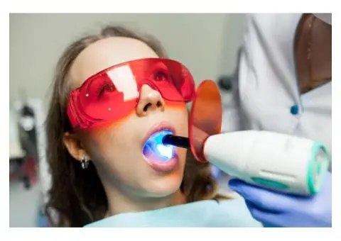 Top Benefits of Choosing Dentist Teeth Whitening Over DIY Methods