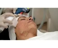 Laser Hair Reduction Treatment