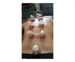 ✨ Learn Hijama, Massage & Alternative Therapies in London! ✨