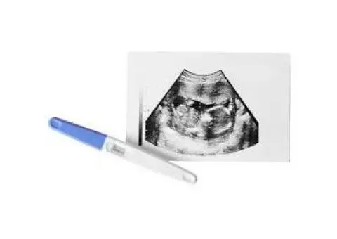 Ultrasound Baby Scan Watford – Expert Care from Start to Finish