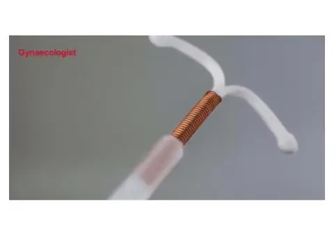 Quick & Comfortable Coil Removal in London by Private Specialists