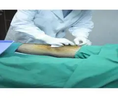 Knee Specialist Services Available in Hale