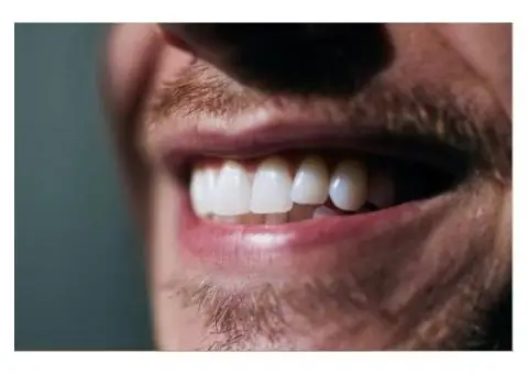 Expert Dental Hygienist in Folkestone – Gentle, Thorough & Friendly Care!
