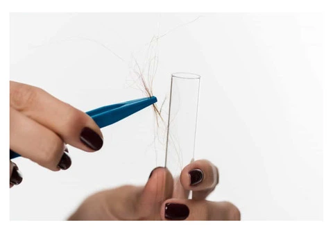 Discover Your Triggers: Hair Intolerance Test in Cheshire, UK!