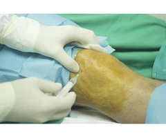 Expert Knee Surgeon in Warrington – Personalised Treatment for Knee Conditions