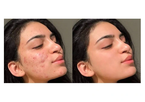Photo retouching service