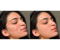Photo retouching service