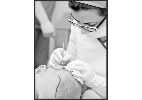 Say Goodbye to Hair Loss – Discover the Power of Sapphire Blade Technology!