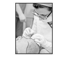 Say Goodbye to Hair Loss – Discover the Power of Sapphire Blade Technology!