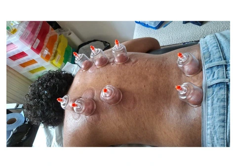 Hijama Cupping Mastery: The Complete Training Program - 2/2