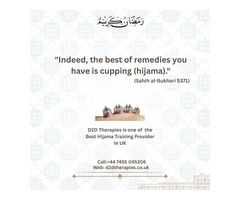 Certified Hijama Cupping Course in London – Hands-On Training at D2D
