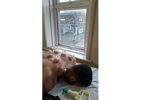 Certified Hijama Cupping Course in London – Hands-On Training at D2D - 2/3