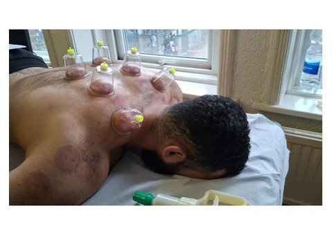 Certified Hijama Cupping Course in London – Hands-On Training at D2D - 3/3