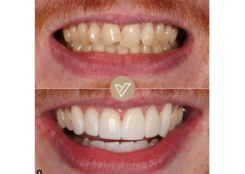 VICI Dental | Leeds Centre - 7/21