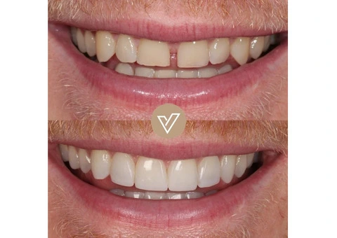 VICI Dental | Leeds Centre - 8/21
