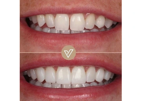 VICI Dental | Leeds Centre - 11/21