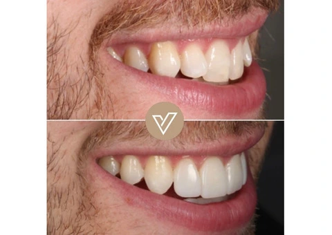 VICI Dental | Leeds Centre - 21/21