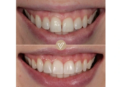 VICI Dental | Pudsey - 13/20