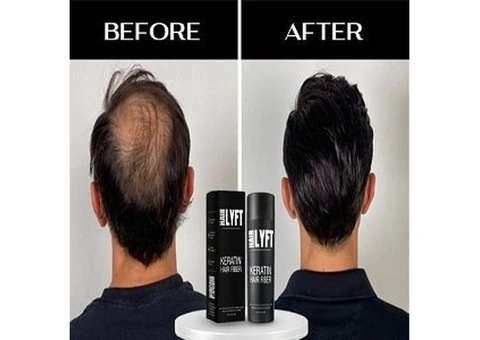 HAIRLYFT LTD - 1/4
