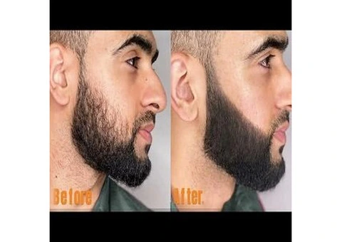 HAIRLYFT LTD - 4/4