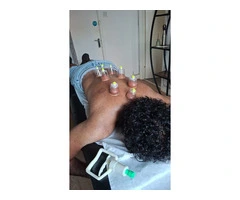 Certified Hijama Cupping Therapy Course – Master the Sunnah Healing Method