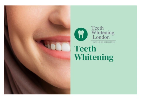 Professional Teeth Whitening Services Across London – Book Today