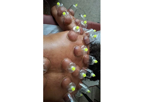 Professional Hijama Cupping Therapy Course – Sunnah-Based Practical Training