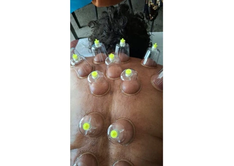 Professional Hijama Cupping Therapy Course – Sunnah-Based Practical Training - 2/2