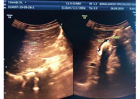 Fusion Radiology Ltd - 2/4
