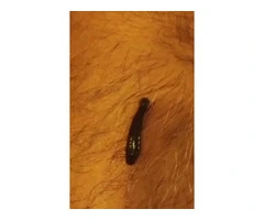 Leech Therapy Course London – From Sunnah to Science