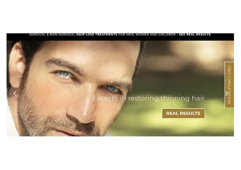 Male Hair Loss Treatment Clinic Near Me