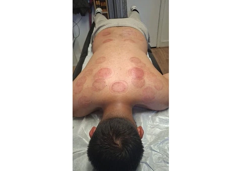 1-Day Hijama Cupping Workshop – Learn & Get Certified - 2/3