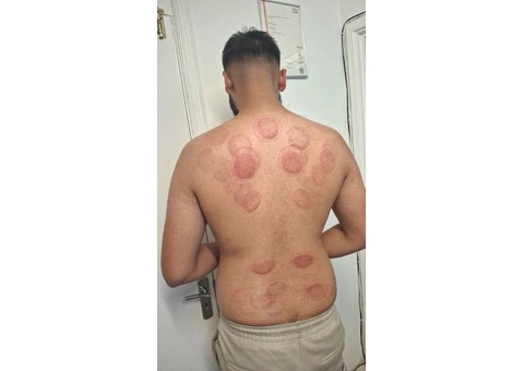 1-Day Hijama Cupping Workshop – Learn & Get Certified - 3/3