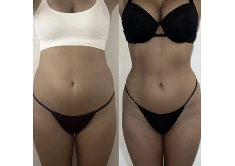 Mobile body treatments... - 4/9