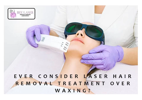 Ever Consider Laser Hair Removal Treatment Over Waxing?