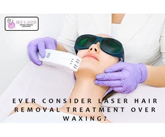 Ever Consider Laser Hair Removal Treatment Over Waxing?