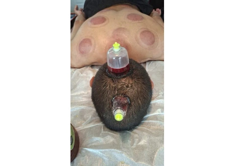Hijama Training Course in London - 2/3
