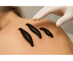 Hands-On Leech Therapy Training for Beginners & Professionals