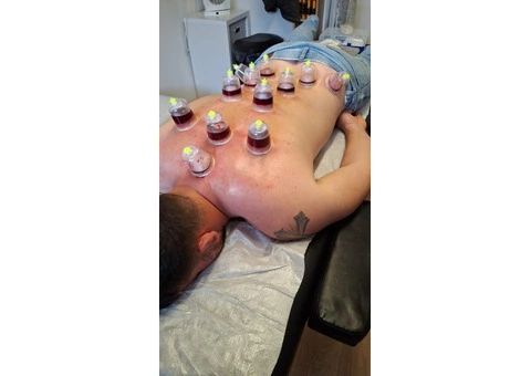 Professional Hijama Cupping Training Course in London - 3/3