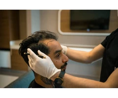Best Hair Transplant Surgery Clinic in Brentwood