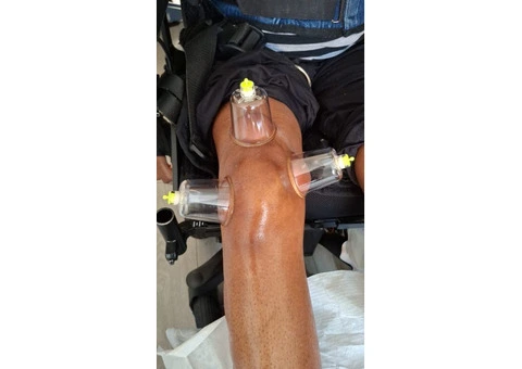 Certified Hijama Cupping Therapy Training - 1/3