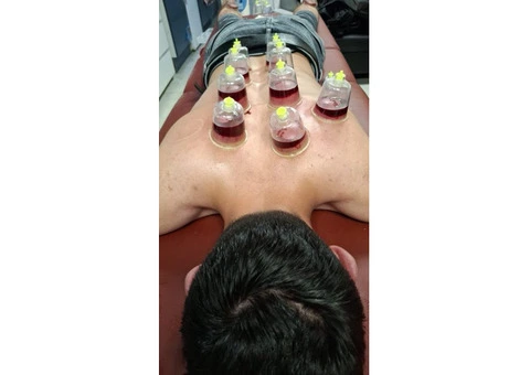 Certified Hijama Cupping Therapy Training - 3/3