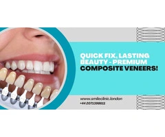 Quick Fix, Lasting Beauty - Premium Composite Veneers!