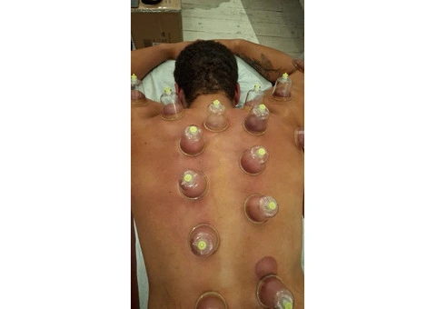 🩺 Holistic Healing with Hijama – Training Program - 3/3