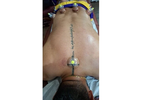 📍 Enroll in our Hijama Cupping Course in London. - 2/3