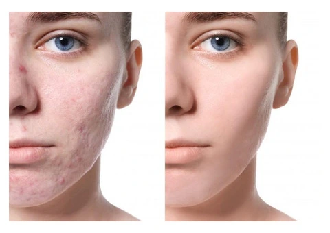 Beauty Treatments & Aesthetics | The Beauty Clinic Southsea